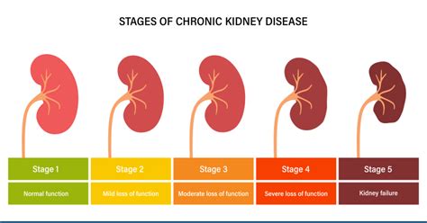chronic renal insufficiency atmore al Setting & participants: Adults with mild to moderate CKD enrolled in the Chronic Renal Insufficiency Cohort (CRIC) Study